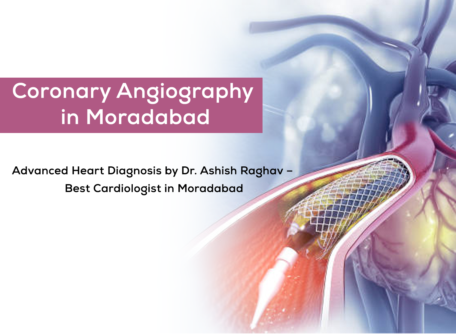 Coronary Angiography in Moradabad